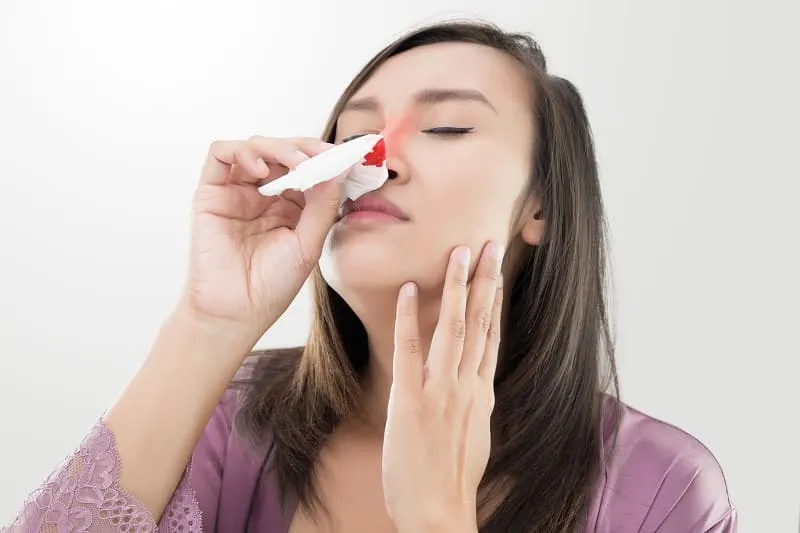 Tratamiento Integral para la Epistaxis Nasal en Centro Médico Santa Luz
